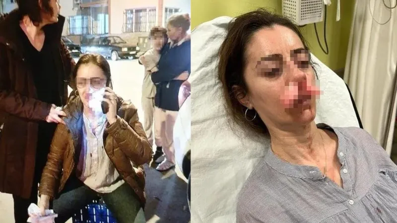 Edirne'de Skandal! Eşinin Sevgilisi Sandığı Kadına Otomobil Kapısıyla Saldırdı!