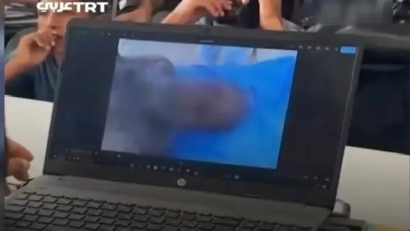 İsrail vahşetini geldiği son nokta: Terör devletinin "Organ hırsızlığı" belgelendi! A Haber'de dikkat çeken yorum: İsrail organ mafyasının merkezidir